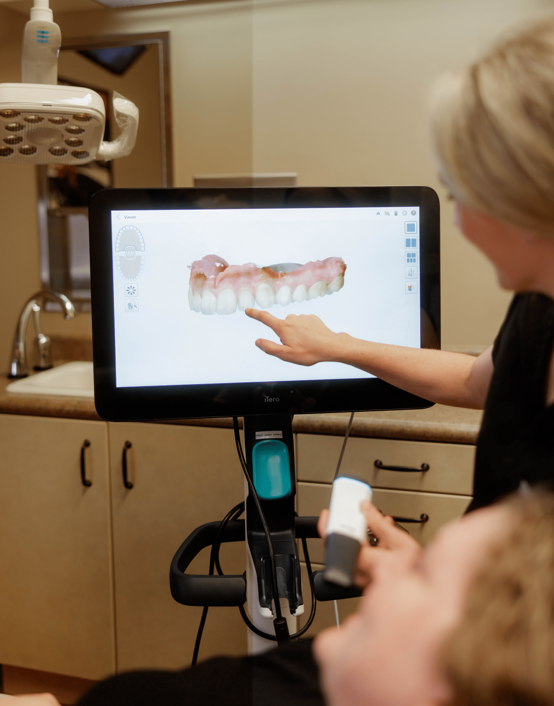 iTero Digital Scan Richmond Center for Advanced Dentistry in Richmond, VA